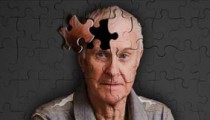 Alzheimer’ın 10 Belirtisi ve Tedavi Yöntemleri