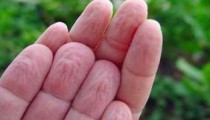 Parmakların Suda Buruşmasının Gerçek Nedeni