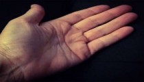 Ellerinizin Ortaya Çıkardığı 6 Şaşırtıcı Hastalık